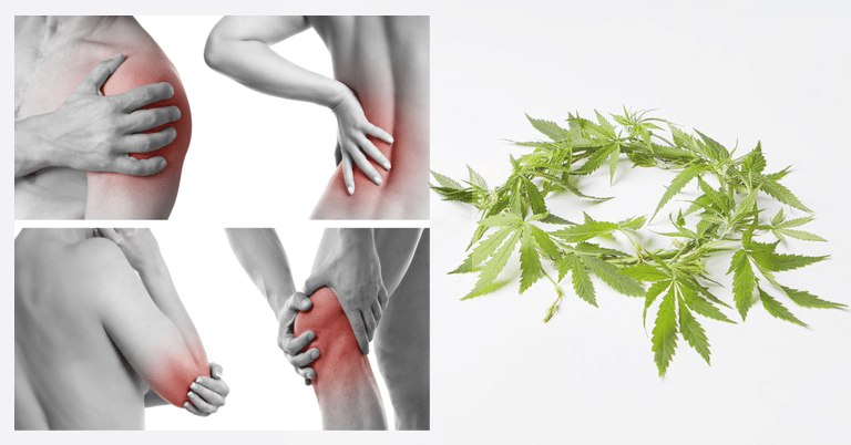 Le CBD peut-il aider les personnes atteintes de fibromyalgie ? 5